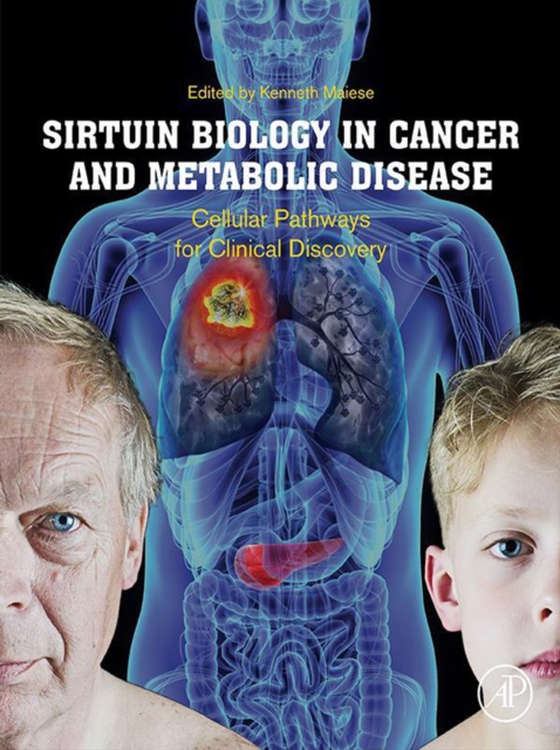 Sirtuin Biology in Cancer and Metabolic Disease (e-bog) af -