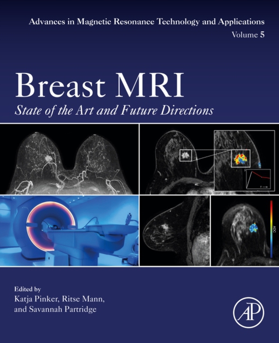 Breast MRI (e-bog) af -