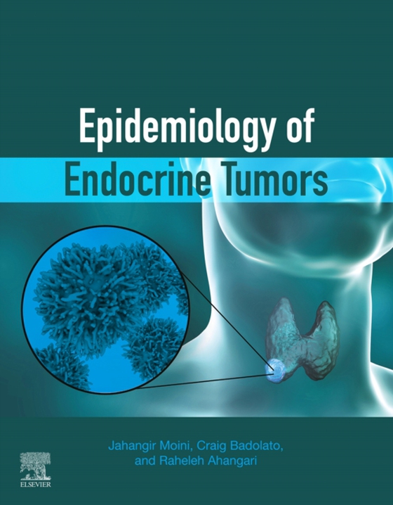 Epidemiology of Endocrine Tumors (e-bog) af Ahangari, Raheleh
