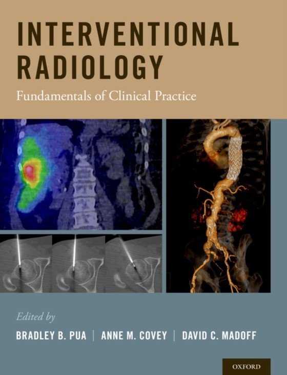 Interventional Radiology (e-bog) af -