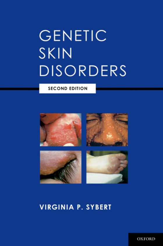 Genetic Skin Disorders (e-bog) af Sybert, Virginia