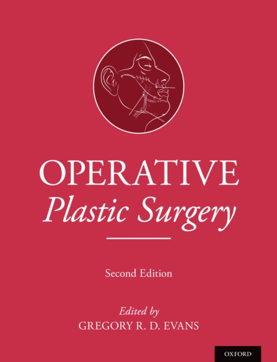 Operative Plastic Surgery (e-bog) af -