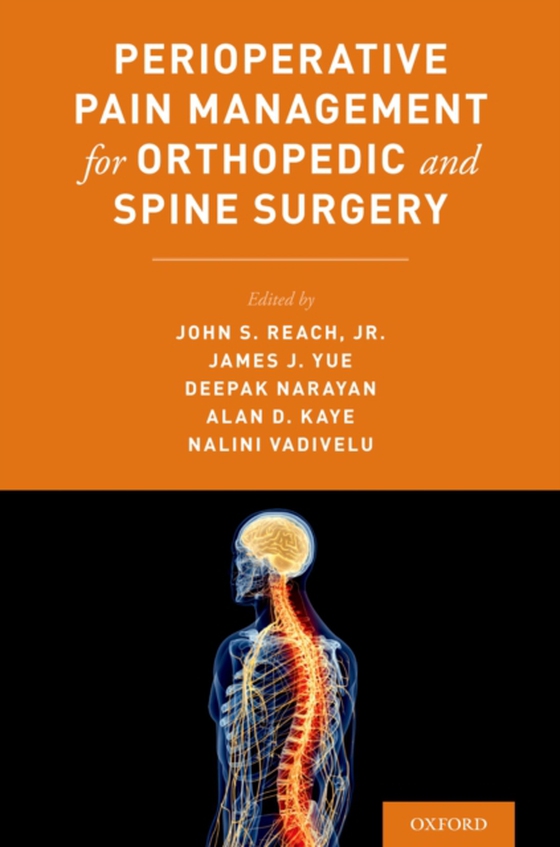 Perioperative Pain Management for Orthopedic and Spine Surgery (e-bog) af -