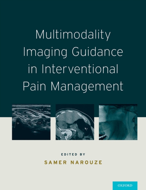 Multimodality Imaging Guidance in Interventional Pain Management