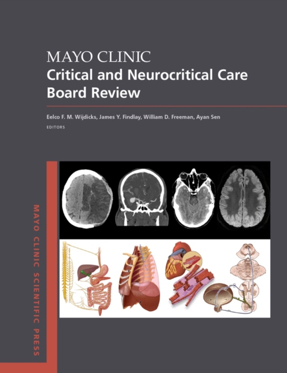 Mayo Clinic Critical and Neurocritical Care Board Review (e-bog) af -