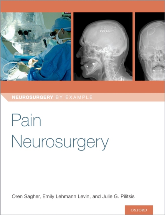 Pain Neurosurgery (e-bog) af -