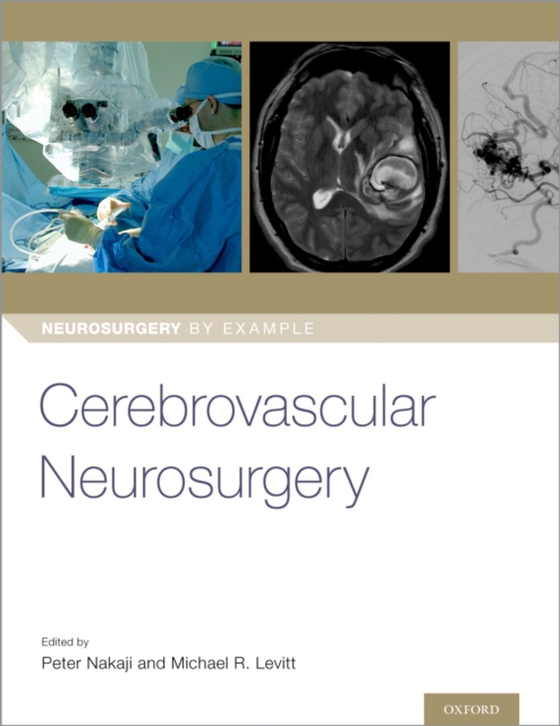 Cerebrovascular Neurosurgery