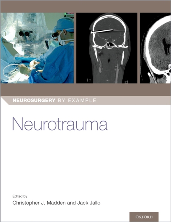 Neurotrauma (e-bog) af -