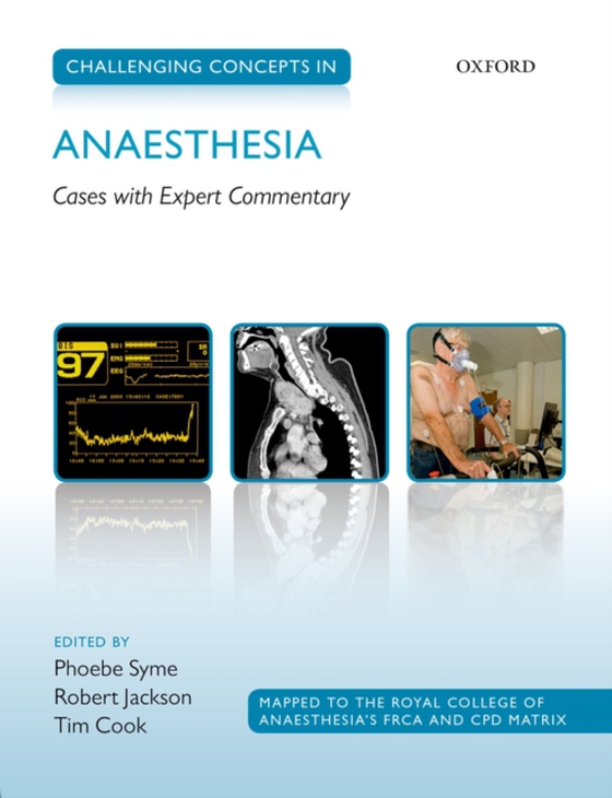 Challenging Concepts in Anaesthesia (e-bog) af -