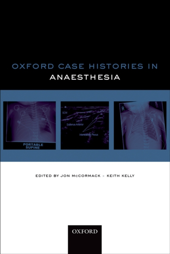 Oxford Case Histories in Anaesthesia