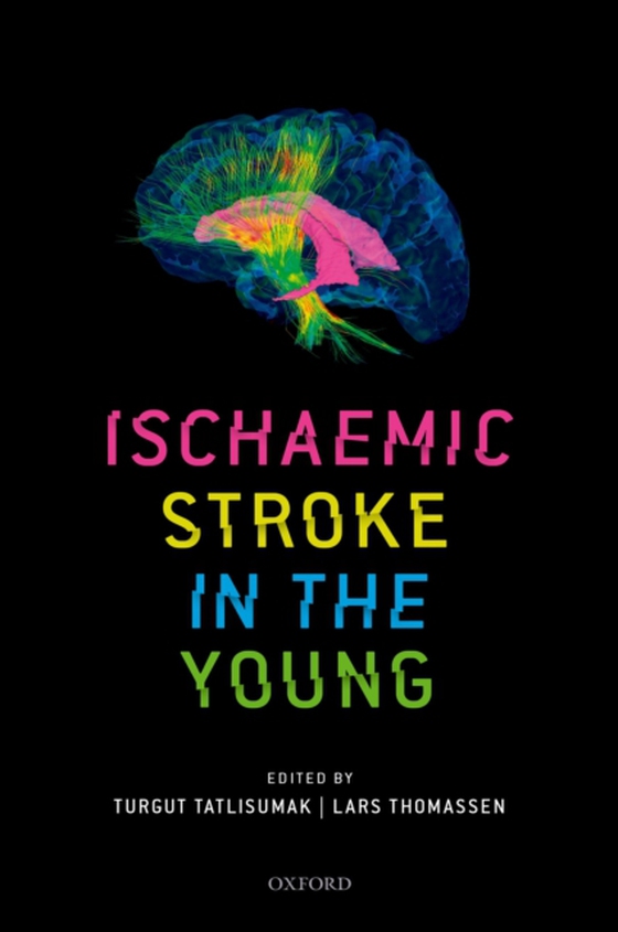 Ischaemic Stroke in the Young (e-bog) af -