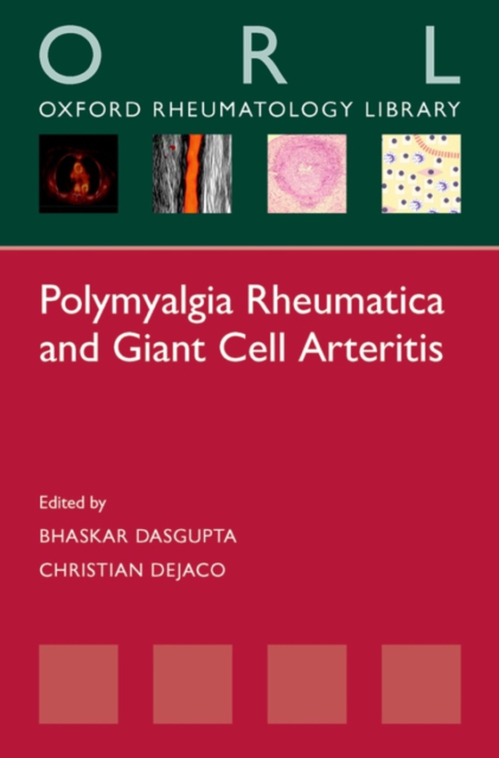 Polymyalgia Rheumatica and Giant Cell Arteritis (e-bog) af -