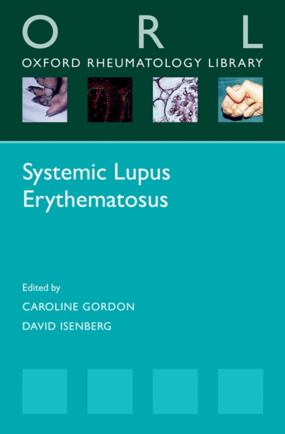 Systemic Lupus Erythematosus (e-bog) af -