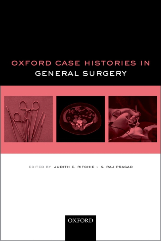 Oxford Case Histories in General Surgery (e-bog) af -