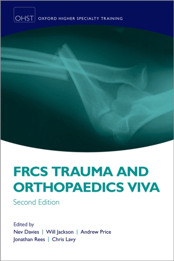 FRCS Trauma and Orthopaedics Viva (e-bog) af Lavy, Chris