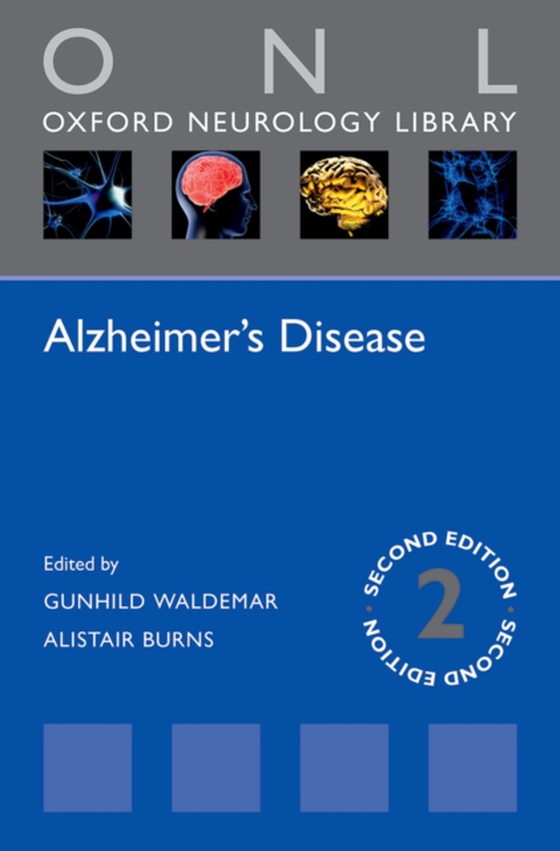 Alzheimer's Disease (e-bog) af -