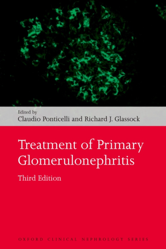 Treatment of Primary Glomerulonephritis (e-bog) af -