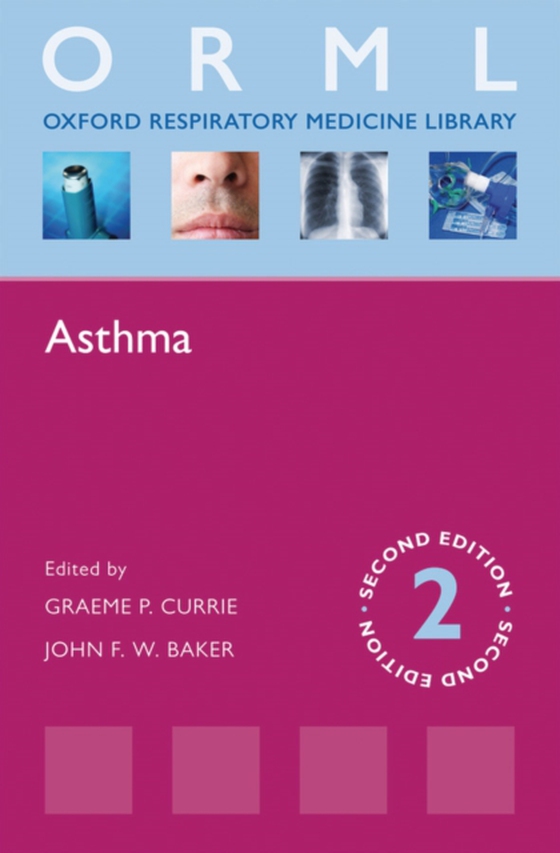 Asthma (e-bog) af -