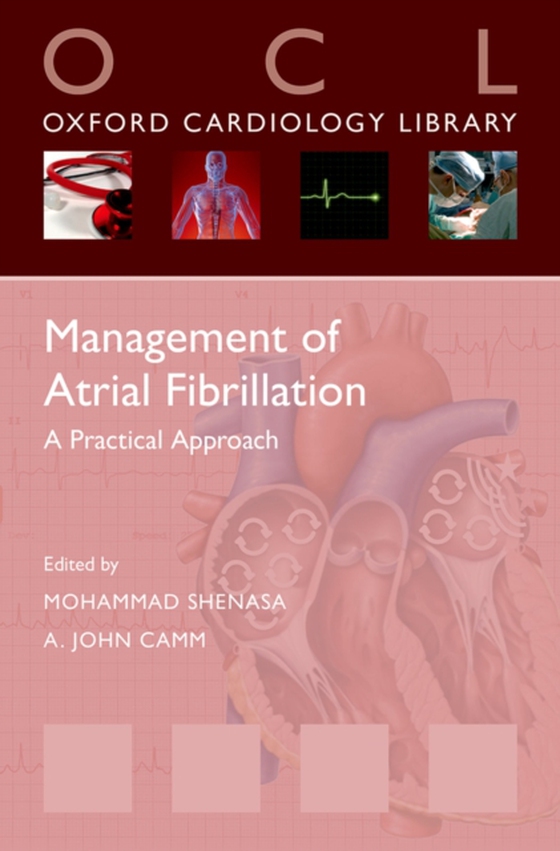 Management of Atrial Fibrillation (e-bog) af -