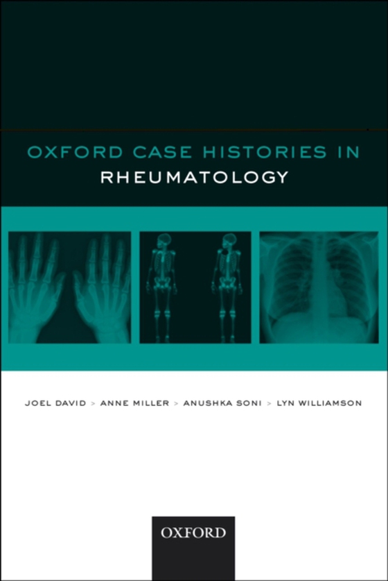 Oxford Case Histories in Rheumatology (e-bog) af Williamson, Lyn