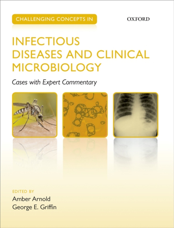 Challenging Concepts in Infectious Diseases and Clinical Microbiology (e-bog) af -