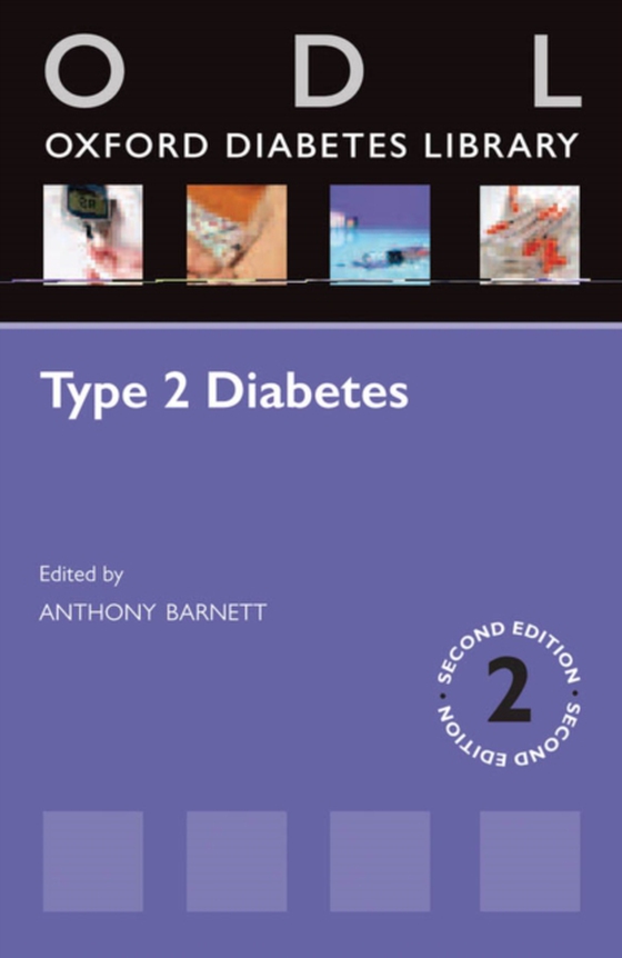 Type 2 Diabetes (e-bog) af -
