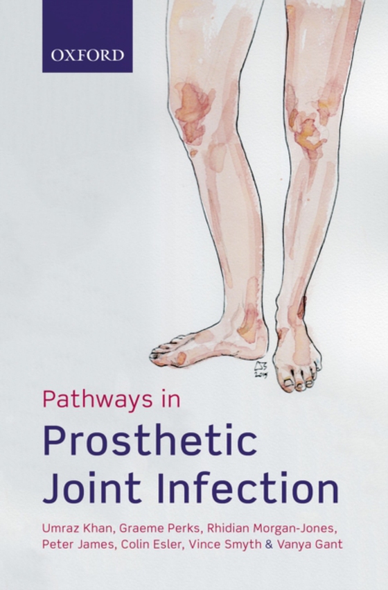 Pathways in Prosthetic Joint Infection (e-bog) af Gant, Vanya