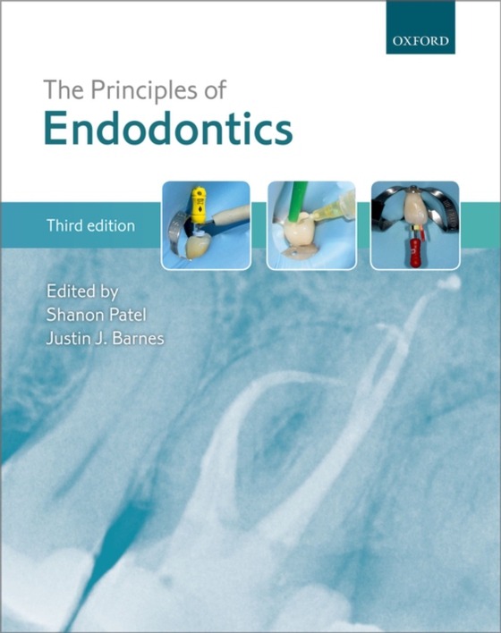 Principles of Endodontics (e-bog) af -