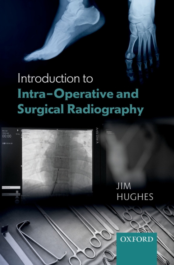 Introduction to Intra-Operative and Surgical Radiography (e-bog) af Hughes, Jim