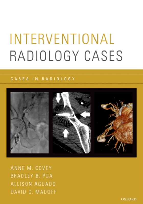 Interventional Radiology Cases (e-bog) af -