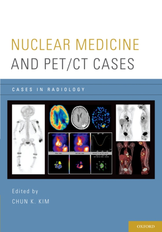 Nuclear Medicine and PET/CT Cases (e-bog) af -