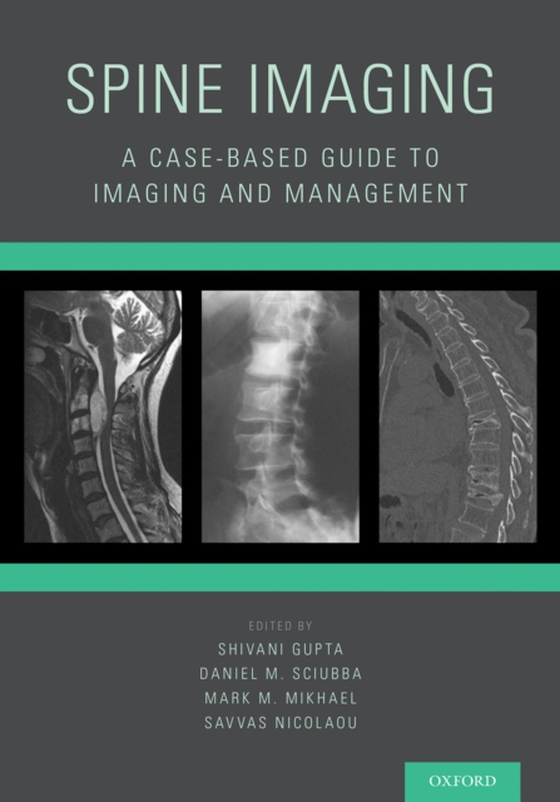 Spine Imaging (e-bog) af -