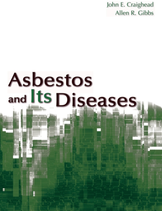 Asbestos and its Diseases (e-bog) af -