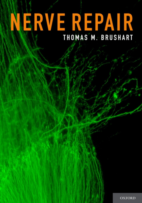 Nerve Repair (e-bog) af Brushart, Thomas M.