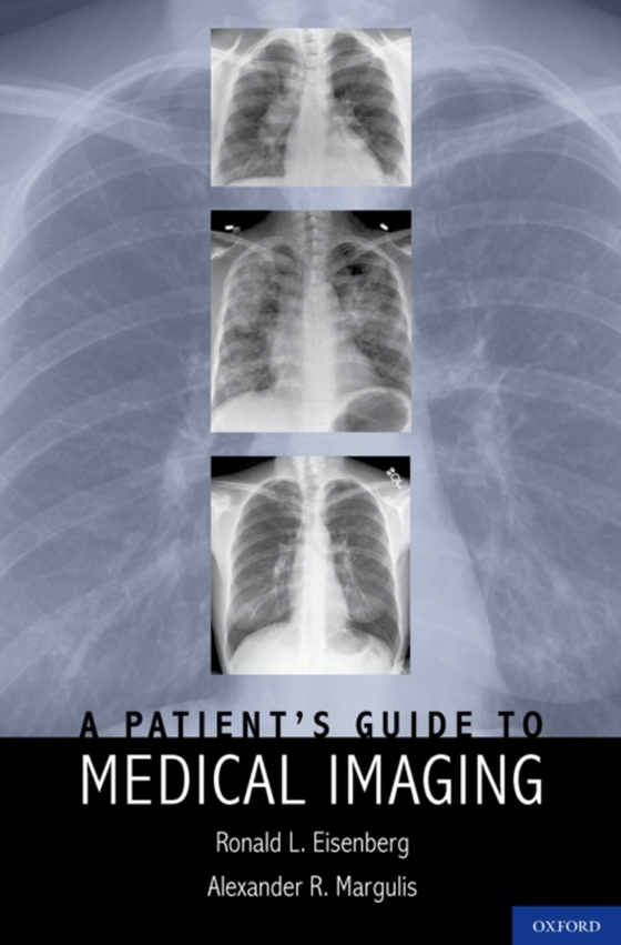 Patient's Guide to Medical Imaging (e-bog) af Alexander Margulis, MD