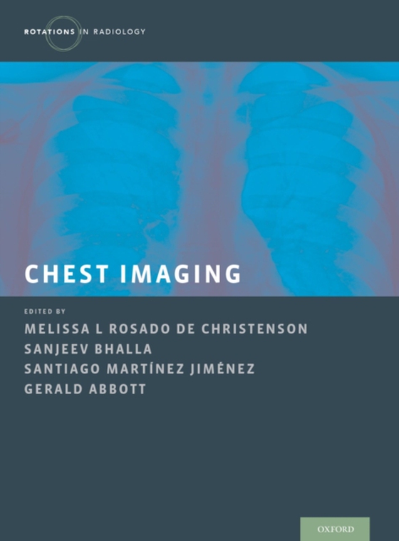 Chest Imaging (e-bog) af -