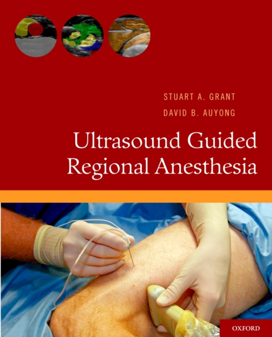 Ultrasound Guided Regional Anesthesia (e-bog) af Auyong, David B.