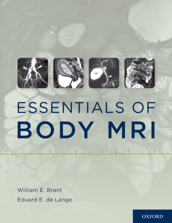 Essentials of Body MRI (e-bog) af -