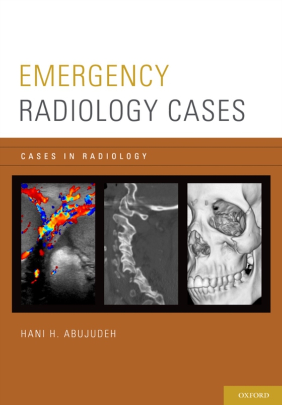 Emergency Radiology Cases (e-bog) af -