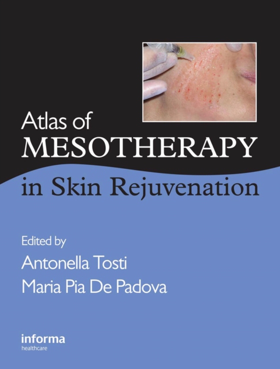 Atlas of Mesotherapy in Skin Rejuvenation (e-bog) af -