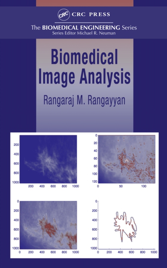 Biomedical Image Analysis (e-bog) af Rangayyan, Rangaraj M.