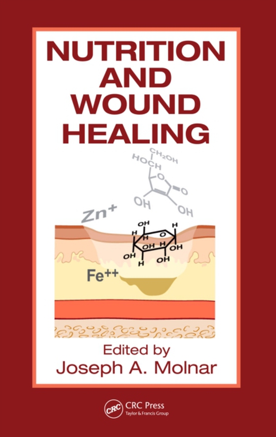 Nutrition and Wound Healing (e-bog) af -