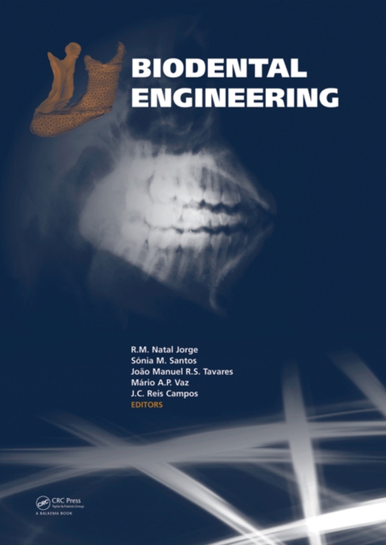 Biodental Engineering (e-bog) af -