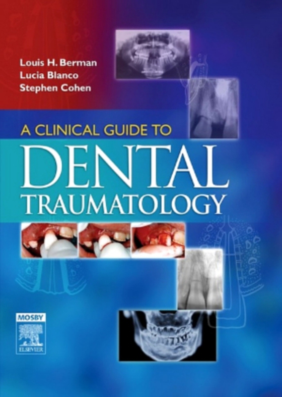 Clinical Guide to Dental Traumatology - E-Book