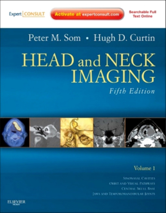 Head and Neck Imaging E-Book (e-bog) af Curtin, Hugh D.