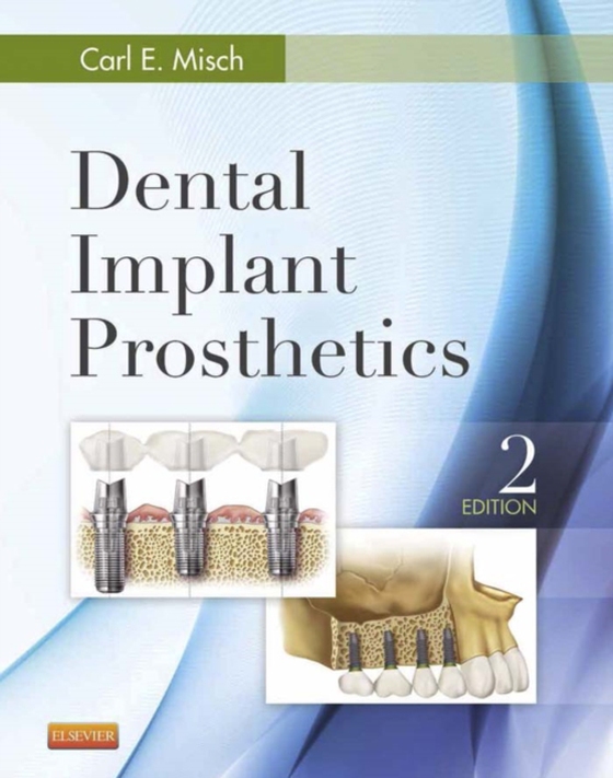 Dental Implant Prosthetics - E-Book