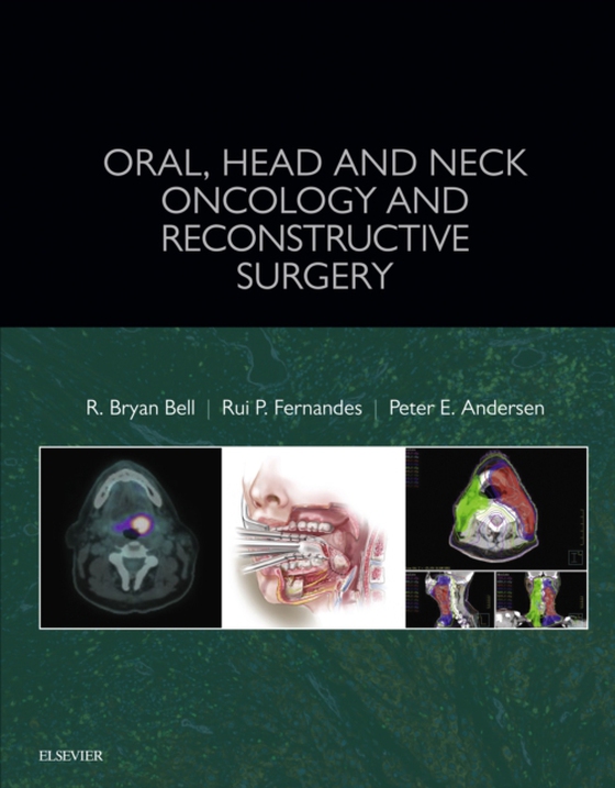 Oral, Head and Neck Oncology and Reconstructive Surgery - E-Book