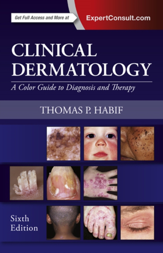 Clinical Dermatology E-Book