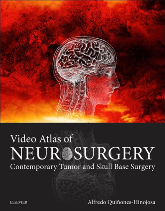 Video Atlas of Neurosurgery E-Book (e-bog) af Quinones-Hinojosa, Alfredo