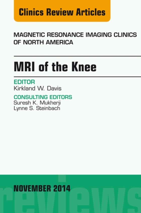 MRI of the Knee, An Issue of Magnetic Resonance Imaging Clinics of North America (e-bog) af Davis, Kirkland W.